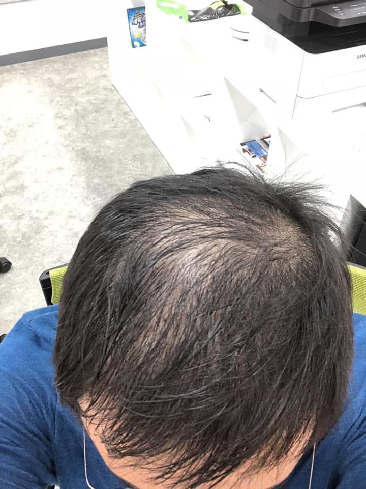 도브로 머리 감기, 탈모에 정말 효과 있을까? 화장품 개발자의 5년 실험기